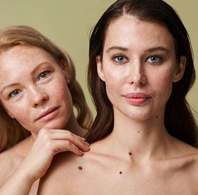 Zwei Frauen mit makelloser Haut, die ästhetische Hautbehandlungen im Zentrum Aestheticum erhalten.